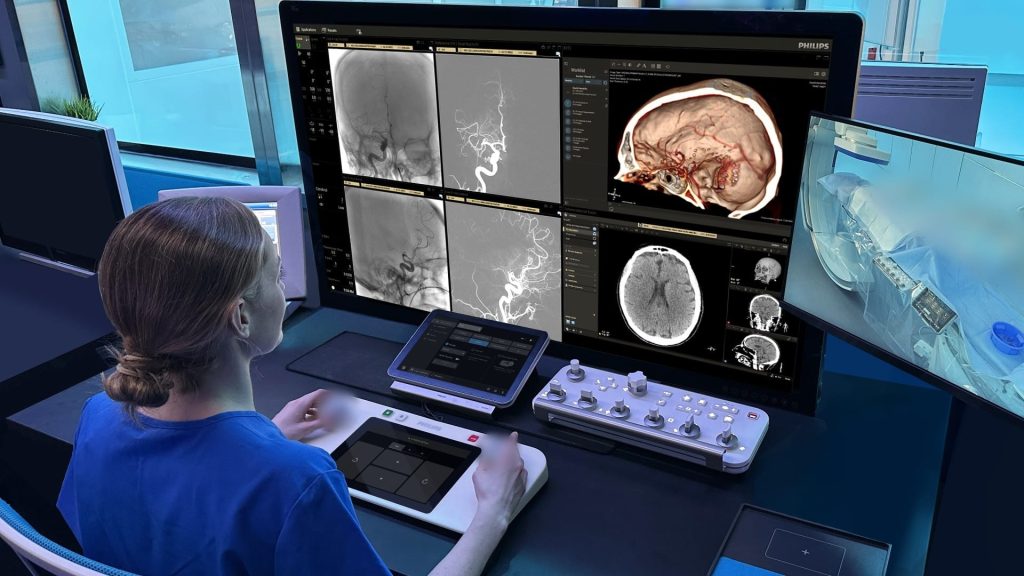 PHILIPS-ictus