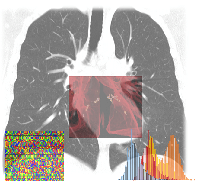 AI-SCoRE _Progetto Microsoft Nvidia OSR_low