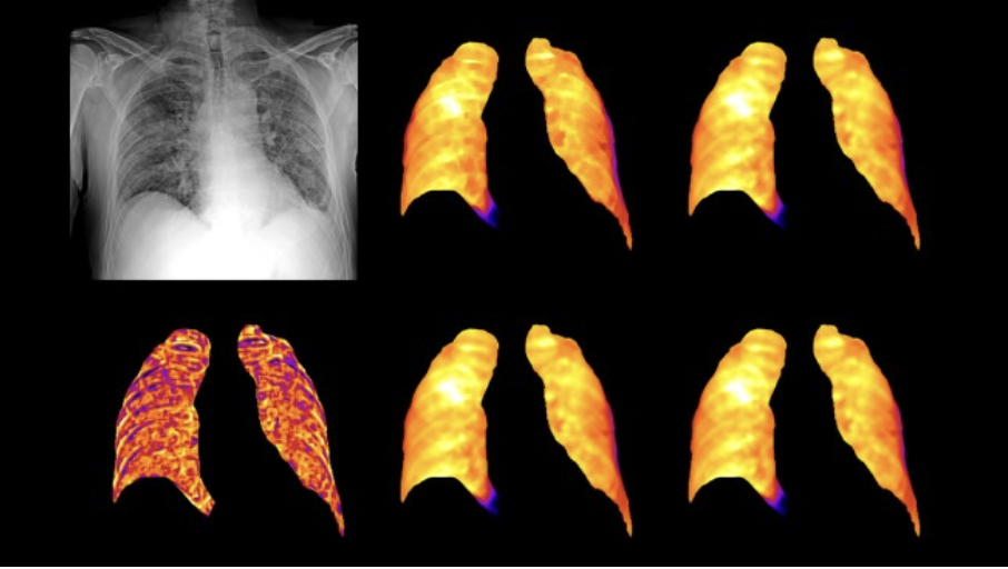 radiografia aws