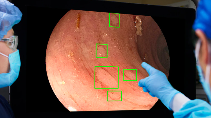 AI-in-Gastroenterologia-aigo