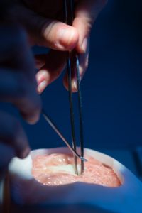 PRINTMED-3D - Tailor-made Organs
